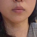채움약국 | 고양시 행신동 피부관리 비움과채움! 입주변 생리 여드름 진정 케어와 데콜테 에스테틱 솔직 후기 💆‍♀️✨