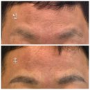 인덕원역(안양판교로)_동 | 안양남자눈썹 잘하는 곳 바니 앤 피그 인덕원역 눈썹맛집