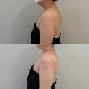 천안 웨딩케어 성지! 불당동 <케이엠에스테틱> - 천안 탕탕이는 일타강사 가을팀장님께!