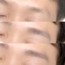 아인메디컬 이미지