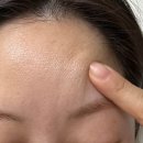 (주)강남셀바이오뱅크 | 스킨부스터 추천 세렉소(Celexo) 시카 엑소좀, 어븀레이저 시술 후기, 통증 효과 등