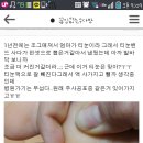 발바닥에 난 티눈..!약혐주의 이미지