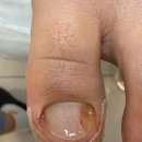 레푸스 정자점 | 레푸스분당정자점 김수민 푸스플레게 지정 발톱 스케일링 10% 할인 이벤트! 4/13~4/27