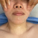 정피부관리 - 동구 | 원하정뷰티 원신흥동피부관리 대전피부관리 보습관리 후기 촉촉해요!