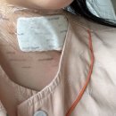 씨유 이대목동병원점 | 갑상선암 수술 후기(이대목동병원/목절개/비용/회복기간 등)