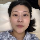 58 | 진주 에스테틱 | '채지움뷰티' 닥토필케어(필링)로 물광피부 된 후기!