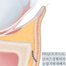 브리즈성형외과의원 | 브리즈 눈밑지방재배치, PRS논문이 탄생하기까지