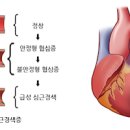 협심증 나타나는 이유, 방안은??? 이미지