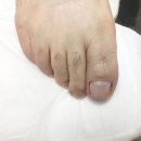 세븐일레븐 화성반송중앙점 | 동탄 발톱무좀, 레푸스동탄반송점 발관리 솔직후기