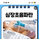 서울엠비(MB)내과의원 | 상기 불명의 흉통- 심장내과에서 심장초음파, 심전도, 자율신경계검사, 혈액검사 후기