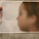 육호애견 | 낮은 코, 복코 코 수술 후기 [수술 당일~일주 일차]