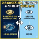 커스텀아이즈 | 퍼스널아이즈 라식, 일반 라식과 뭐가 다를까? 차이점 분석!