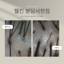 5909 | 서현 두피케어 웰킨 분당서현점 후기 두피 각질 관리 파워 스케일링