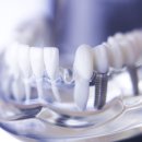 ONE DENTAL 이미지