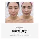 헤세라 | 기장 ‘헤세라’ 얼굴 관리 받고 놀랐던 후기