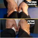 숄더짐 | 대구체형교정 스톤짐남산점 거북목 라운드숄더 심한 직장인 솔직후기