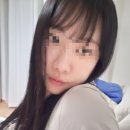 우아한뭉티기 | 울쎄라 전후 비교, 붓기, 통증 등 볼패임 없이 받은 얼굴형 관리 후기 2달 차