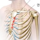 오른쪽 가슴 통증 이유 6가지 이미지