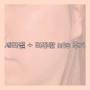 자인 | 영주 자인병원 피부과 후기