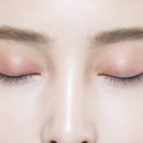 와인성형외과의원 네이버블로그