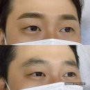 2115 | 남양주 다산남자눈썹 짱구될까 고민이라면 꼭 읽어보세요.