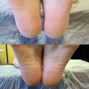 라라뷰티샵 | 부산패디플래닝 해운대발각질관리샵 “해운대라라뷰티” 솔직후기