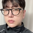 제일종합에너지 | 대구쿨소닉 무너진 라인 끌어올린 펜타입 울쎄라 리얼 후기