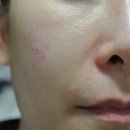 주식회사 젠퓨어 (GENPEAU) | 젠퓨어 르프리엘 선블록쿠션 :: 무자극인증 쿠션파데추천