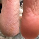 오니크네일 이미지