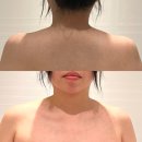 탤런트 - 동래구 | 홍대 피부관리 탤런트에스테틱 승모근관리 에너지테라피 잘하는 곳 후기