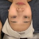 동아1차세탁소 | 신도림 피부관리 - 가윤에스테틱 1회 더 결제하고 온 물방울리프팅 관리 후기. 동네 주민 인증