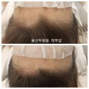 미담케어 이미지