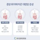 왼쪽 아랫배 통증 원인여자남자 이미지