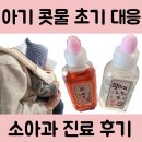 명인당약국 | 아이 콧물 초기 증상, 병원 방문 후 호전된 후기