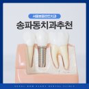서울봄플란트치과의원 | 송파동치과추천, 임플란트도 심미적으로