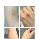 녹십자 동물병원 | 알레르기 검사 MAST에 대한 정보 및 피부과 검사 후기