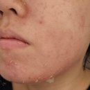새오름컨설팅 | 더물오름 에스테틱 사당피부관리 후기｜사당여드름피부·사당문제성피부 관리 경험