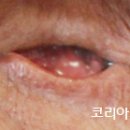 코리아의안센터 이미지