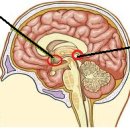 불소(Fluoride): 불면의 근본 원인 이미지