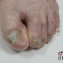 레푸스사상점