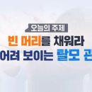 빈 머리를 채워라, 10살 어려 보이는 탈모 관리법 이미지