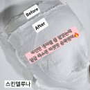 스킨델루나 | 얼굴 축소된 경산 스킨델루나 리셋핏 윤곽관리 2회 리얼 후기