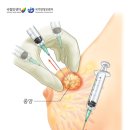 이른비한방병원 이미지