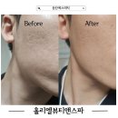 수원-1287 | 수원피부관리 케어 끝판왕 업체 후기