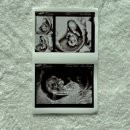 우먼피아여성병원 이미지