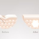 하이코코 이미지