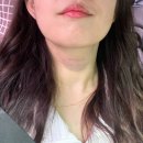 진해의원 | [오늘의일상]바로그의원 진해: 진해 피부과 목주름필러 후기(생생후기 드루와👊🏻)