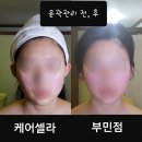 케어셀라 이미지