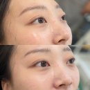 마곡속눈썹펌 아비앙또뷰티마곡본점 속눈썹펌 LC컬 후기