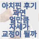 아치날 | 아치핀 후기, 과연 신체 밸런스는 얼마나 좋아질까?
